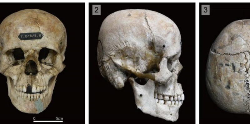 Хвороблива індивідуальність. Учені з’ясували, чому у стародавніх людей з японського поселення були деформовані черепи